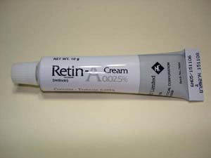 retina-2.jpg